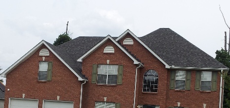 Shingles photo 3